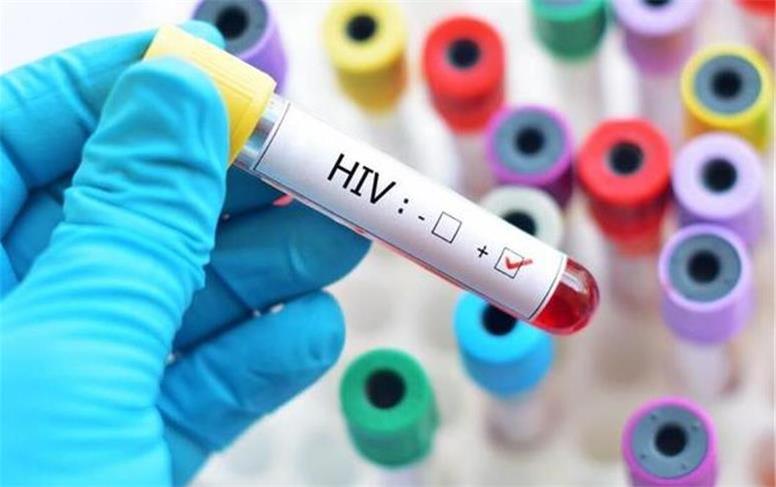 درمان HIV رایگان و محرمانه انجام می‌شود