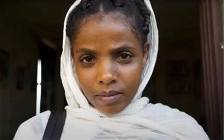 زنی که ۱۶ سال بدون آب و غذ زندگی کردا/ عکس