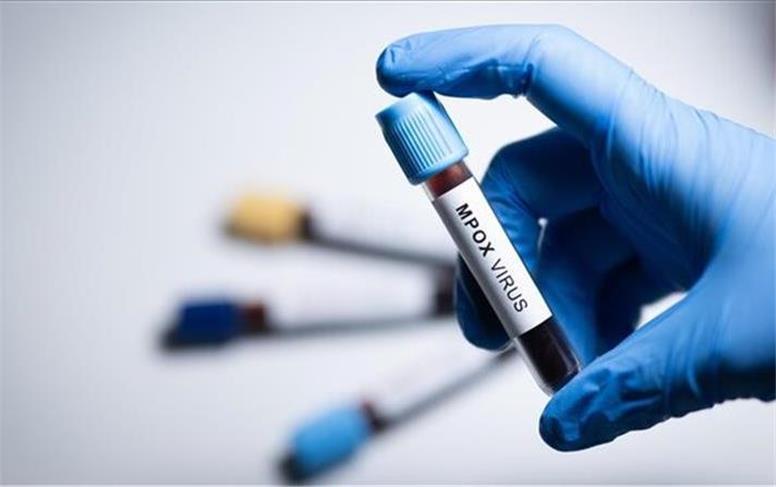 سویه جدیدی از ویروس«ام پاکس» شناسایی شد