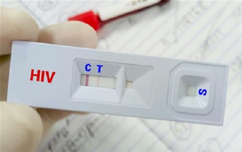 زندگی عادی با وجود HIV؛ خبر خوش وزارت بهداشت از درمان‌های نوین