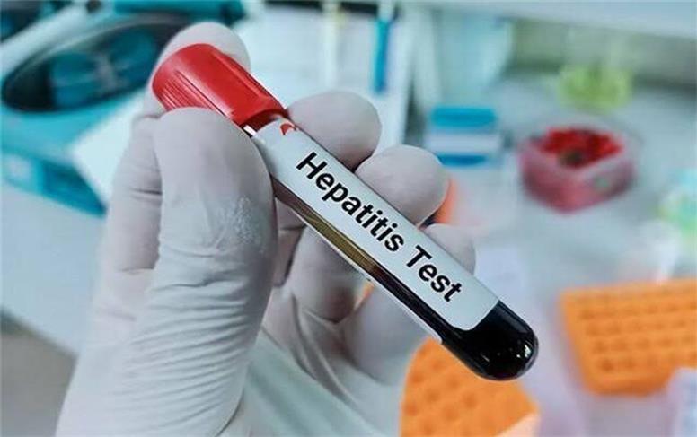 خطر پنهان در کبد؛ هپاتیت چگونه بدون علامت پیشروی می‌کند؟