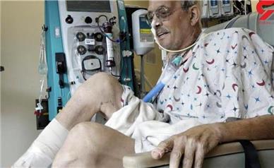 دومین گیرنده قلب خوک هم در آمریکا فوت کرد