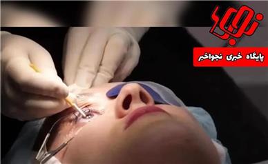 ماجرای نابینا شدن بیماران بیمارستان نگاه/ کامنت‌های مردم و نگرانی‌ها