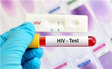 جزئیاتِ تشخیص رایگان و محرمانه HIV در مراکز مشاوره