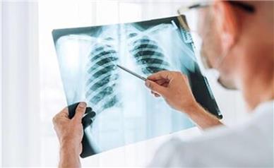 بیماری آنفلوآنزا گاهی کشنده است؟