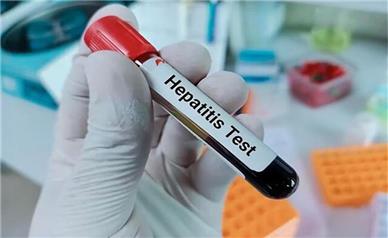 غربالگری هپاتیت در معتادان تحت درمان از اواخر شهریور