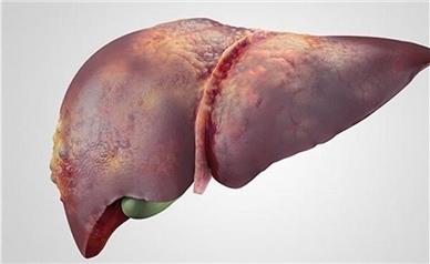 علائم هپاتیت در چهره