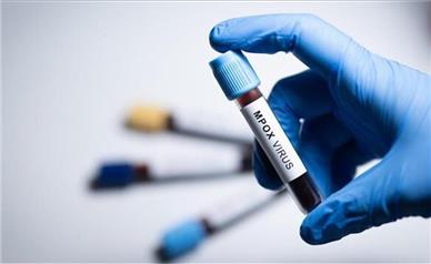 سویه جدیدی از ویروس«ام پاکس» شناسایی شد