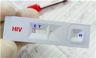 زندگی عادی با وجود HIV؛ خبر خوش وزارت بهداشت از درمان‌های نوین
